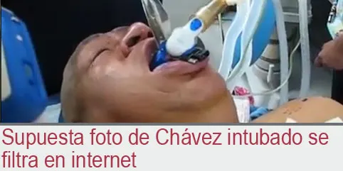 Supuesta foto de Chávez intubado se filtra en internet