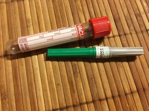 España permite adquirir pruebas de VIH sin prescripción médica