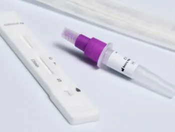 En las últimas 24 horas reporta Salud dos nuevos contagios por COVID-19 en Puebla