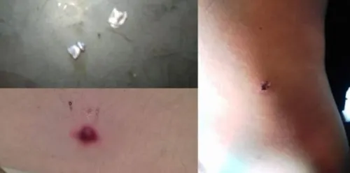 Siete personas resultan heridas por disparos con rifle de balines en Esteban de Antuñano