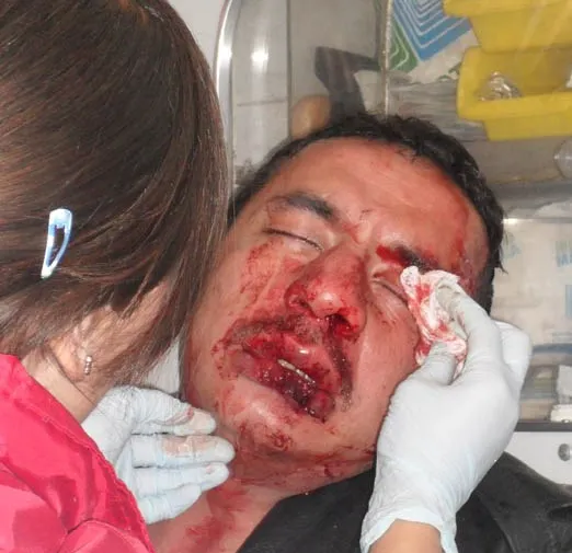 Un detenido por robo luego de los hechos en Texmelucan
