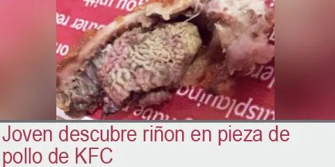 Joven descubre riñon en pieza de pollo de KFC