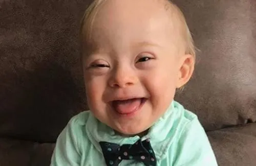 Bebé con Síndrome de Down es la nueva imagen de Gerber