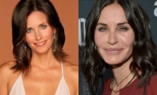 Mónica de “Friends” dice adiós al bótox