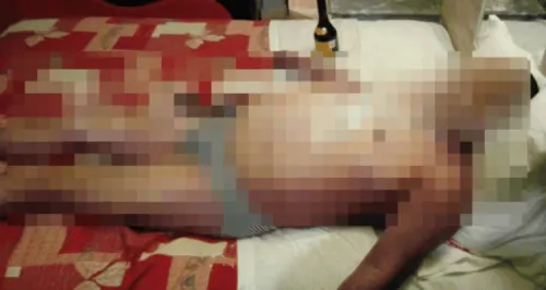 A causa de sobredosis, hombre muere en motel de San Andrés Cholula