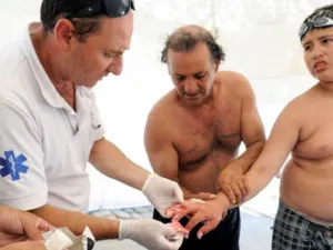 Peces carnívoros atacan a 70 personas en Argentina