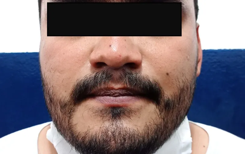 Imagen del artículo