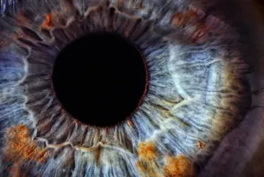 El asombroso síndrome del Ojo Fantasma