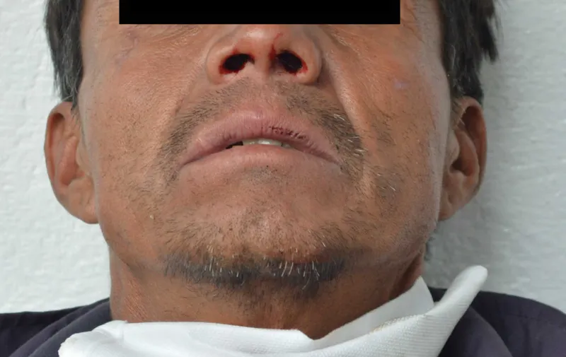 Imagen del artículo