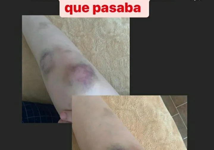 Imagen del artículo