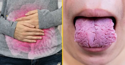 Según el aspecto de tu lengua podrías tener estas enfermedades