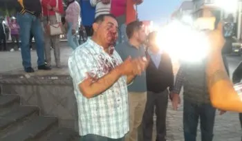 Golpean a Edgar Jiménez, candidato del PAN a la presidencia municipal de Ciudad Serdán