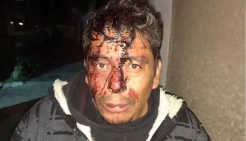 Golpean a taxista tras intentar asaltarlo en la colonia Romero Vargas