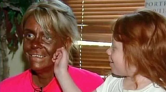 Arrestan a mujer por broncear a su hija de 5 años