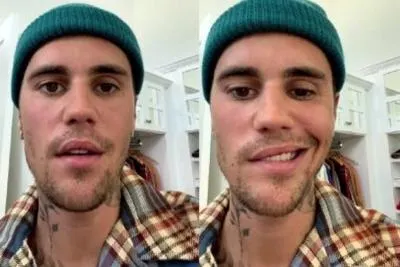 Justin Bieber muestra mejoría de parálisis facial