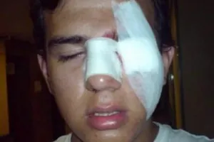 Circula foto falsa de exempleado de Maskota ‘golpeado’
