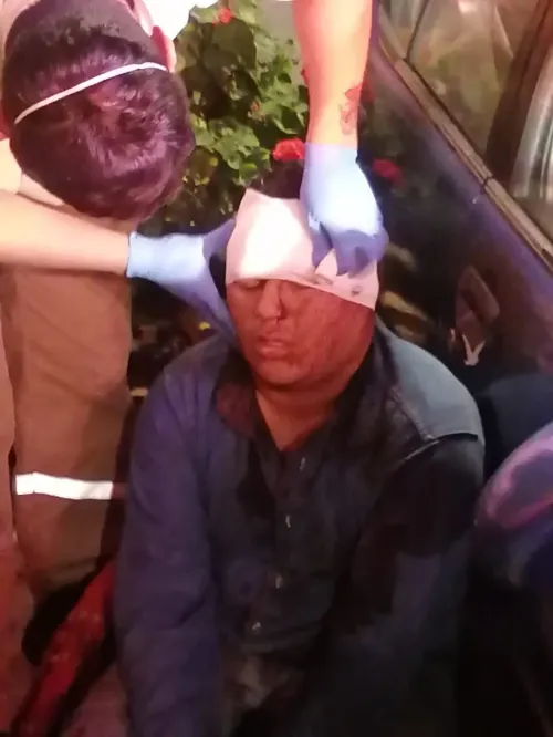 Durante asalto, golpean a hombre en Viveros del Valle