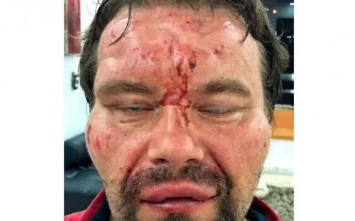 Policías en Venezuela golpean a periodista polaco y lo amenazan con arma de fuego