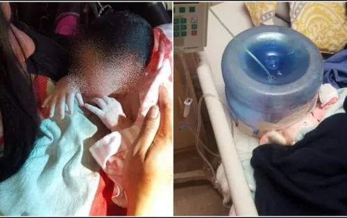 Utilizan garrafón como casco cefálico en hospital de Sonora