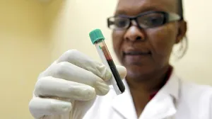 ¿Hallan en la sangre humana una llave para vencer al VIH?