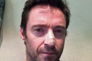 Hugh Jackman dice que está bien, tras nuevo tratamiento contra el cáncer de piel
