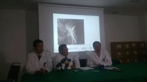 Al año el área de Traumatología y Ortopedia realiza 450 cirugías de caderas