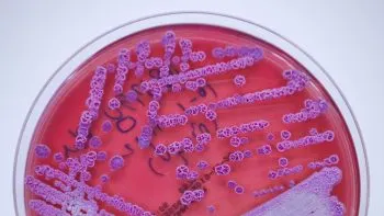 Encuentran bacteria que provoca rara enfermedad en EU