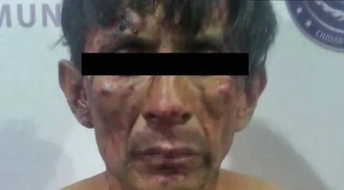 Golpean a delincuente por robar una motosierra en la colonia Santa María