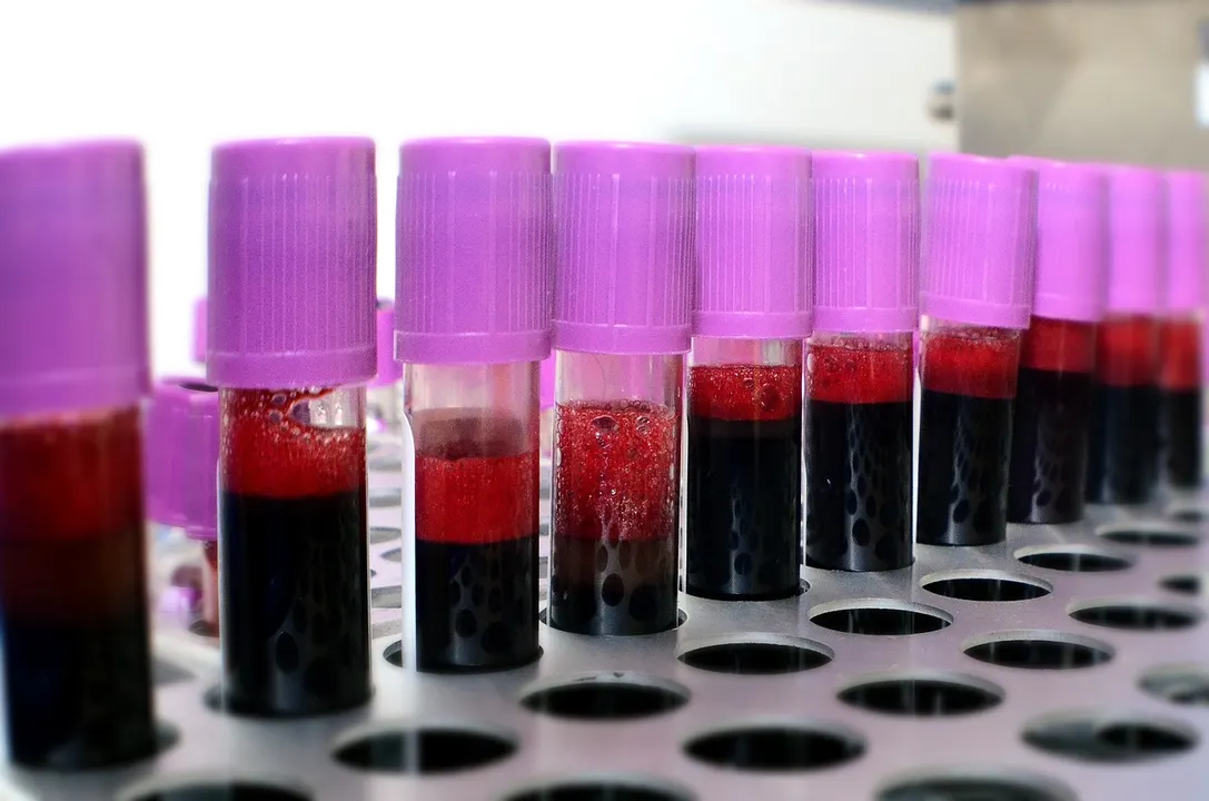 Día Mundial del Donante de Sangre