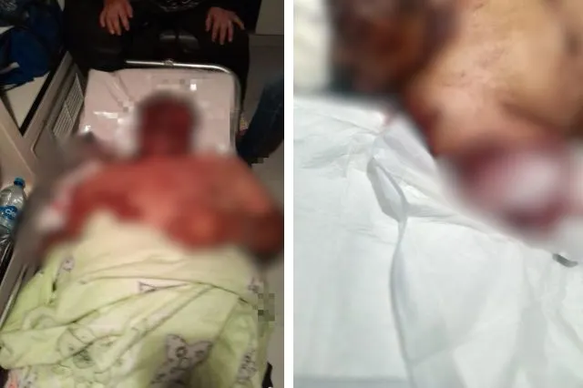 Ataque a reportero Augusto Simón Valencia