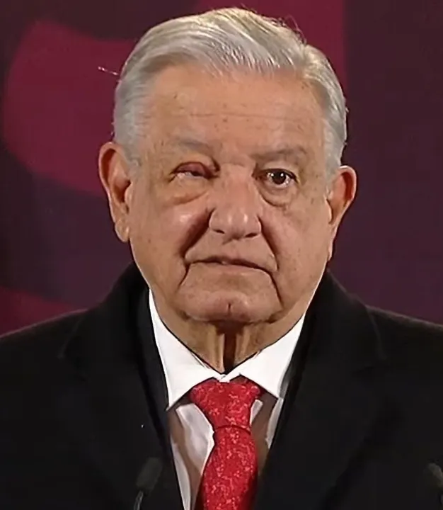 AMLO - sigue - con - ojo - inflamado