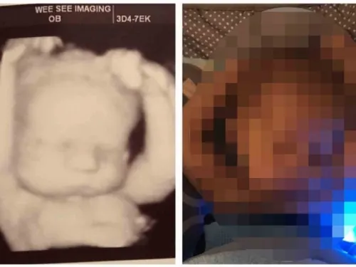 Bebé durmiendo como lo hacía en el útero se viraliza en redes