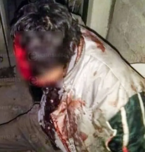 Perro le arranca cuero cabelludo a hombre en la colonia Granjas de San Isidro
