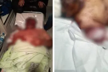 Ataque a reportero Augusto Simón Valencia fue por agredir a una mujer y no por su labor periodística
