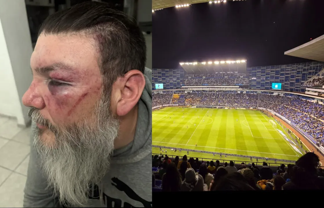 Agresión a Fher Jara