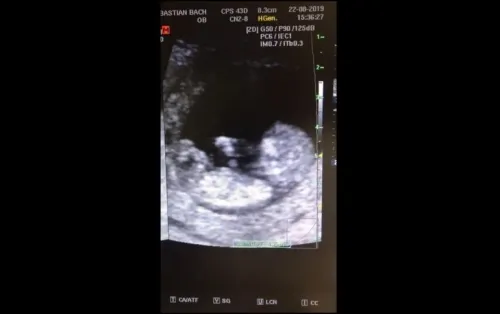 VIDEO: Bebé de 12 semanas “juega a la resbaladilla” en el vientre de su madre