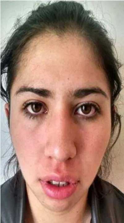 Sentencian a 35 años de prisión a mujer que privó de la vida a su pareja sentimental