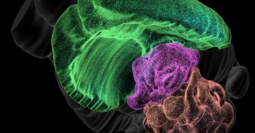 Científicos chinos realizarán el mayor mapa del cerebro humano en 3D