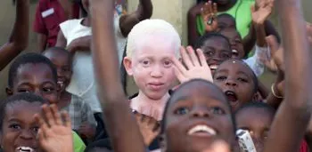 En África, asesinos de joven albino reciben sentencia a 4 años del hecho