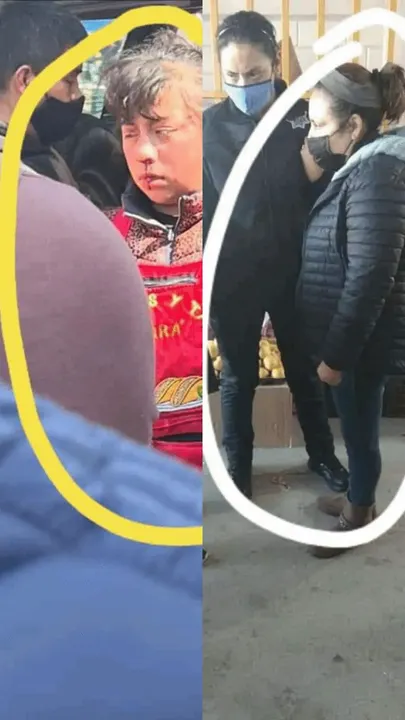 Una mujer celosa golpea a menor en la Central de Abasto