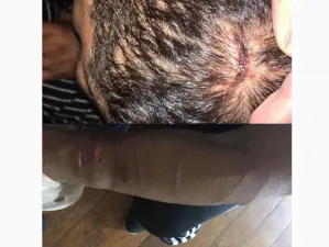 Alberto ‘El Patrón’ muestra sus heridas tras altercado