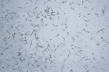 Reporta Salud 82 nuevos contagios por dengue