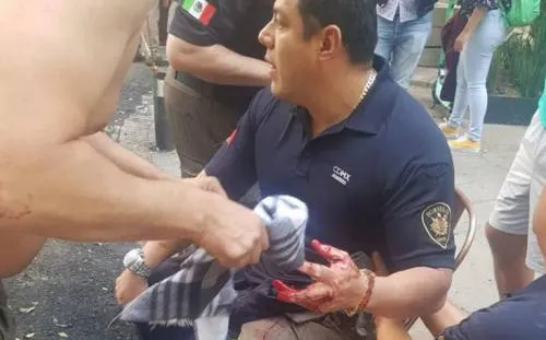 Grave Ismael Figueroa tras ataque directo: Amieva