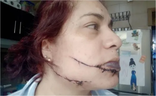 “Sabes de parte de quién es”; a Jennifer le cortaron la cara, sospecha de su ex