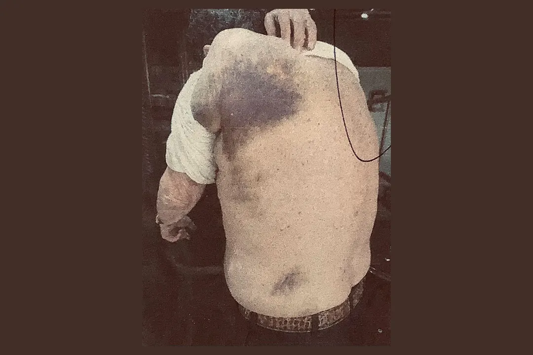 Hombre Golpeado