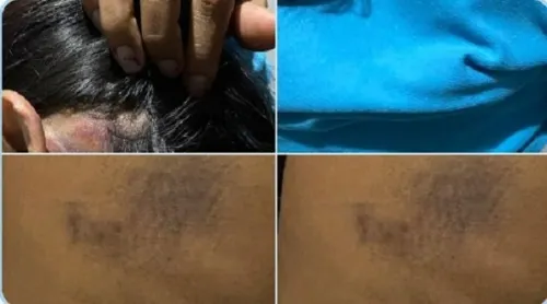 FOTOS: FGE pide a mujer golpeada prueba Covid19 negativa antes de recibir su denuncia