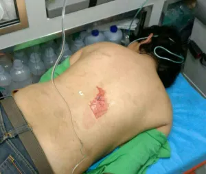 Atiende policía de San Pedro Cholula riña que dejo un muerto
