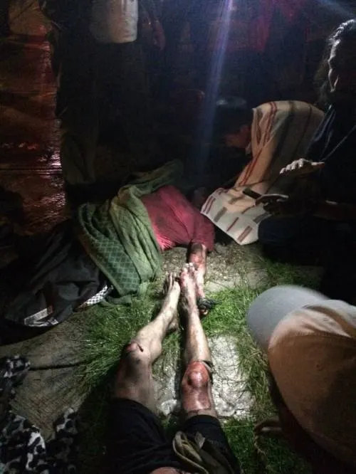 Incendio provocado deja cuatro quemados en Galaxia la Calera