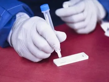Reporta Salud ocho contagios por dengue en las últimas 24 horas