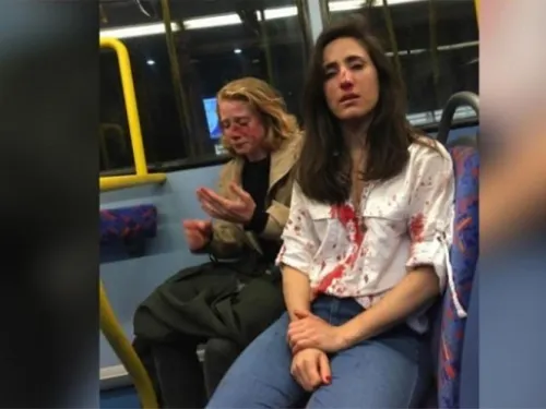 Golpean cruelmente a pareja de mujeres gay en Londres